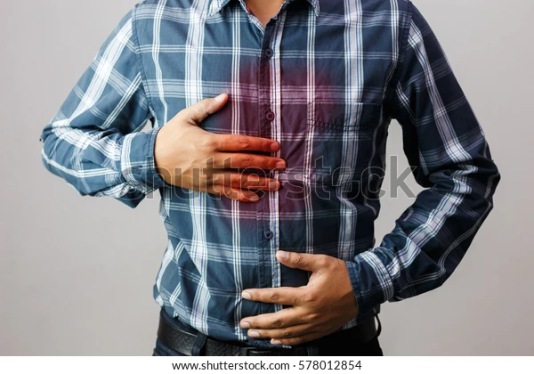 Heartburn: Essential Information